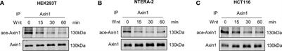 SIRT4-Catalyzed Deacetylation of Axin1 Modulates the Wnt/β-Catenin Signaling Pathway